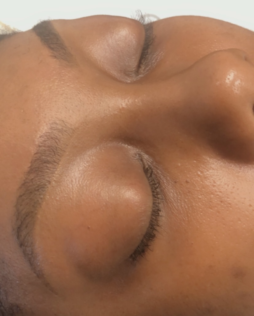 Close-up of a person's face with eyes closed, showing skin texture and facial features, rotated for upright view.