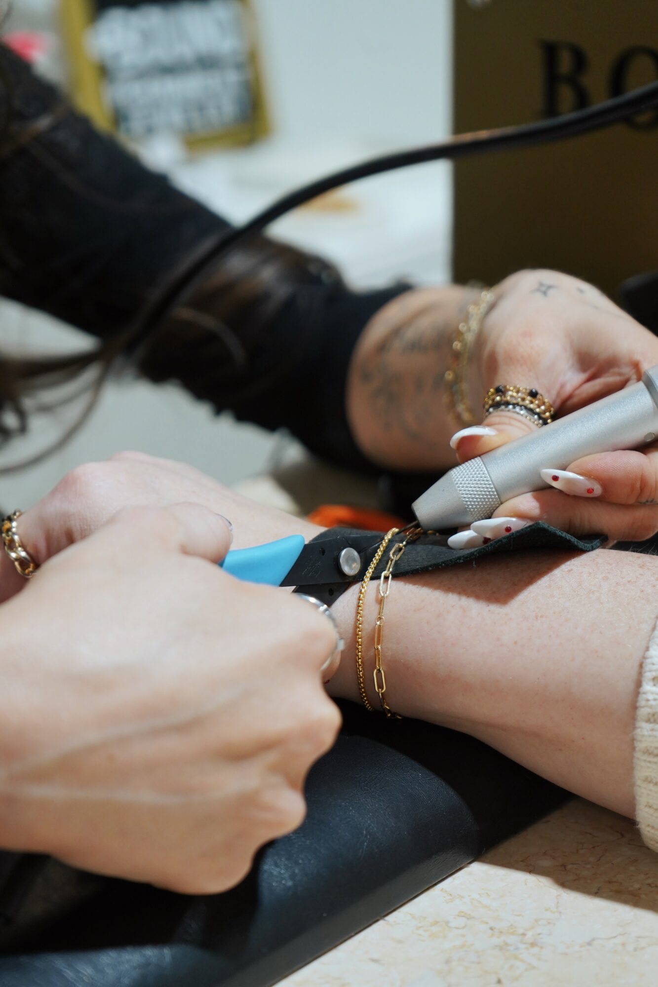 Medical professional performs a procedure on a person's arm with a handheld device, using gloves and jewelry, on a table.